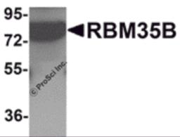 Western blot analysis of RBM35B in human lung tissue lysate with RBM35B antibody at 1 &#956;g/mL.