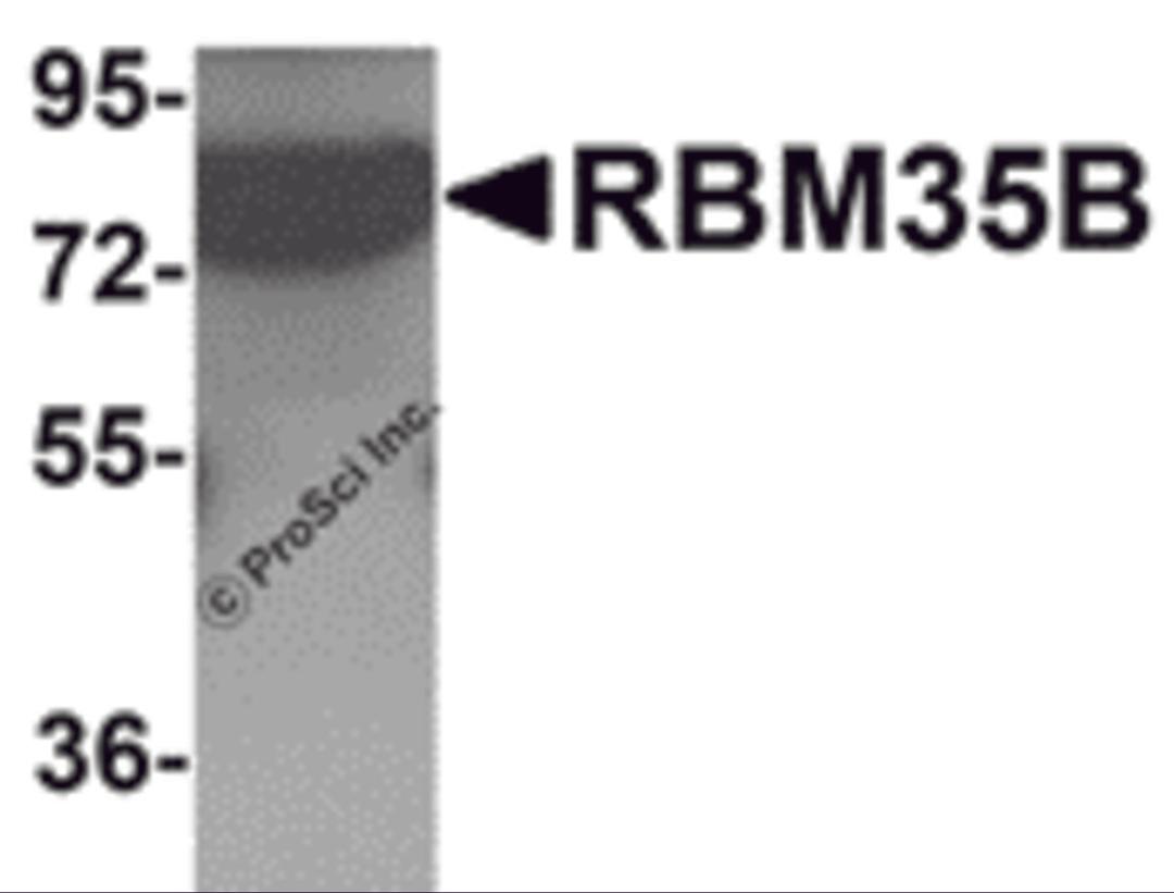 Western blot analysis of RBM35B in human lung tissue lysate with RBM35B antibody at 1 μg/mL.