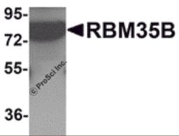 Western blot analysis of RBM35B in human lung tissue lysate with RBM35B antibody at 1 μg/mL.