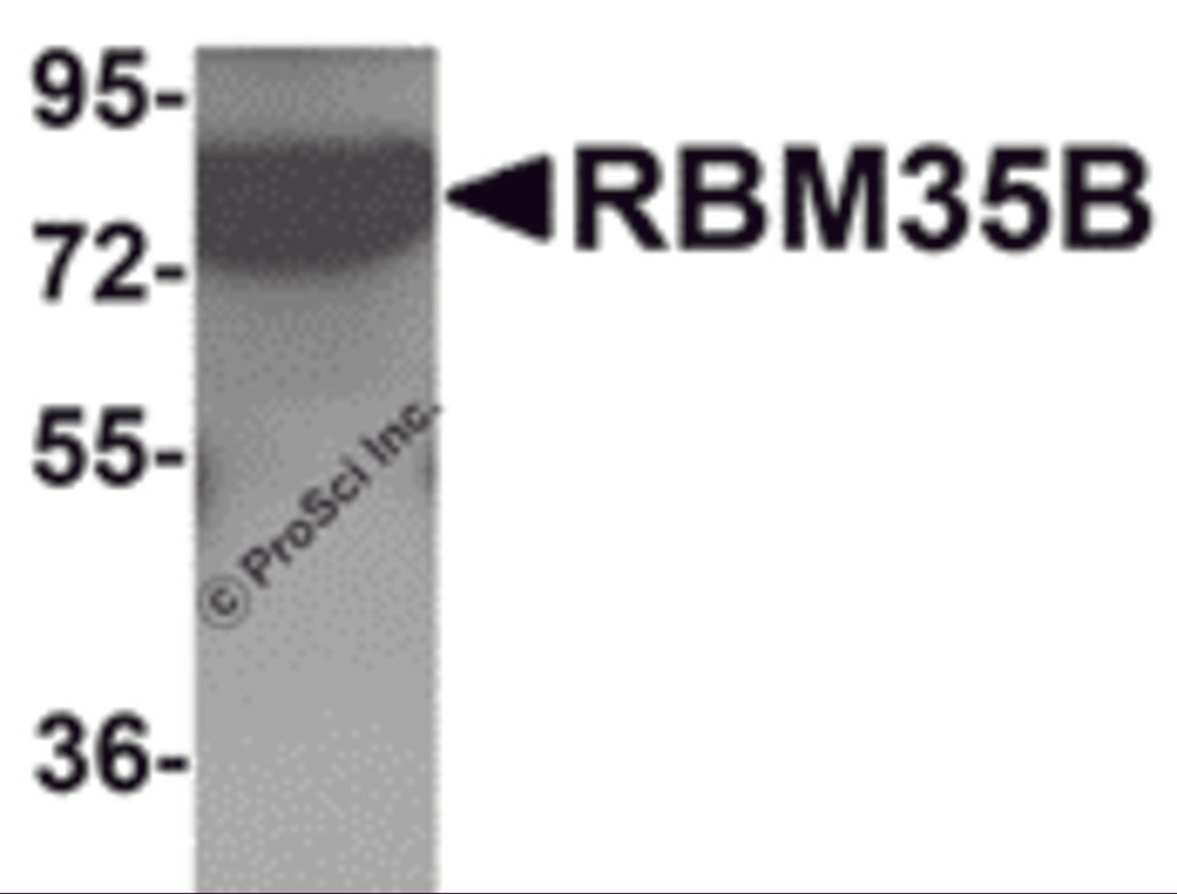 Western blot analysis of RBM35B in human lung tissue lysate with RBM35B antibody at 1 μg/mL.