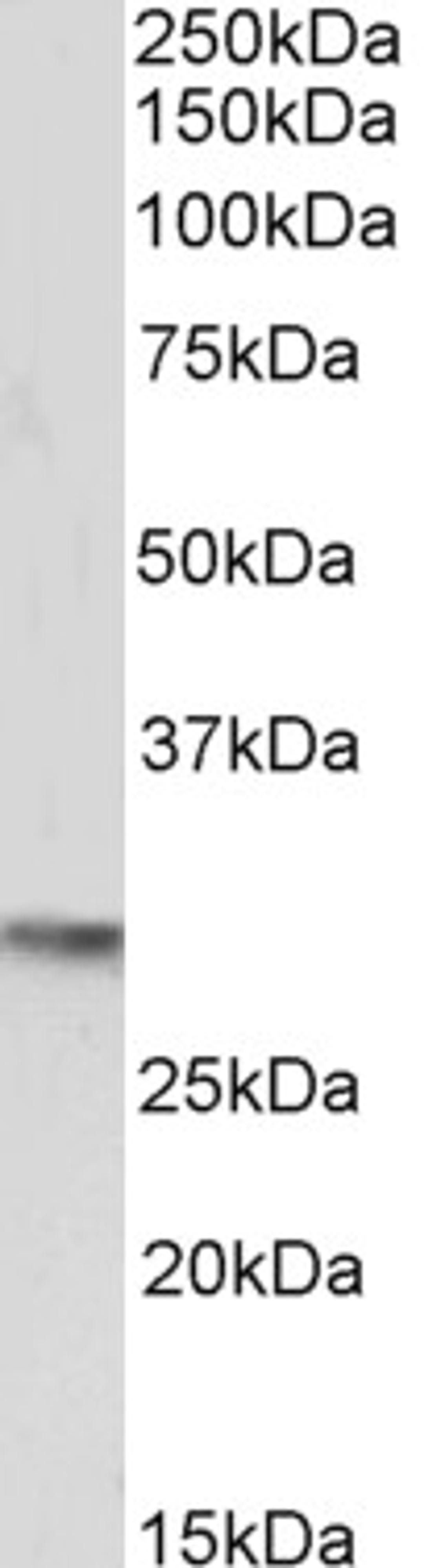 45-991 (0.5ug/ml) staining of Mouse Heart lysate (35ug protein in RIPA buffer). Primary incubation was 1 hour. Detected by chemiluminescence.