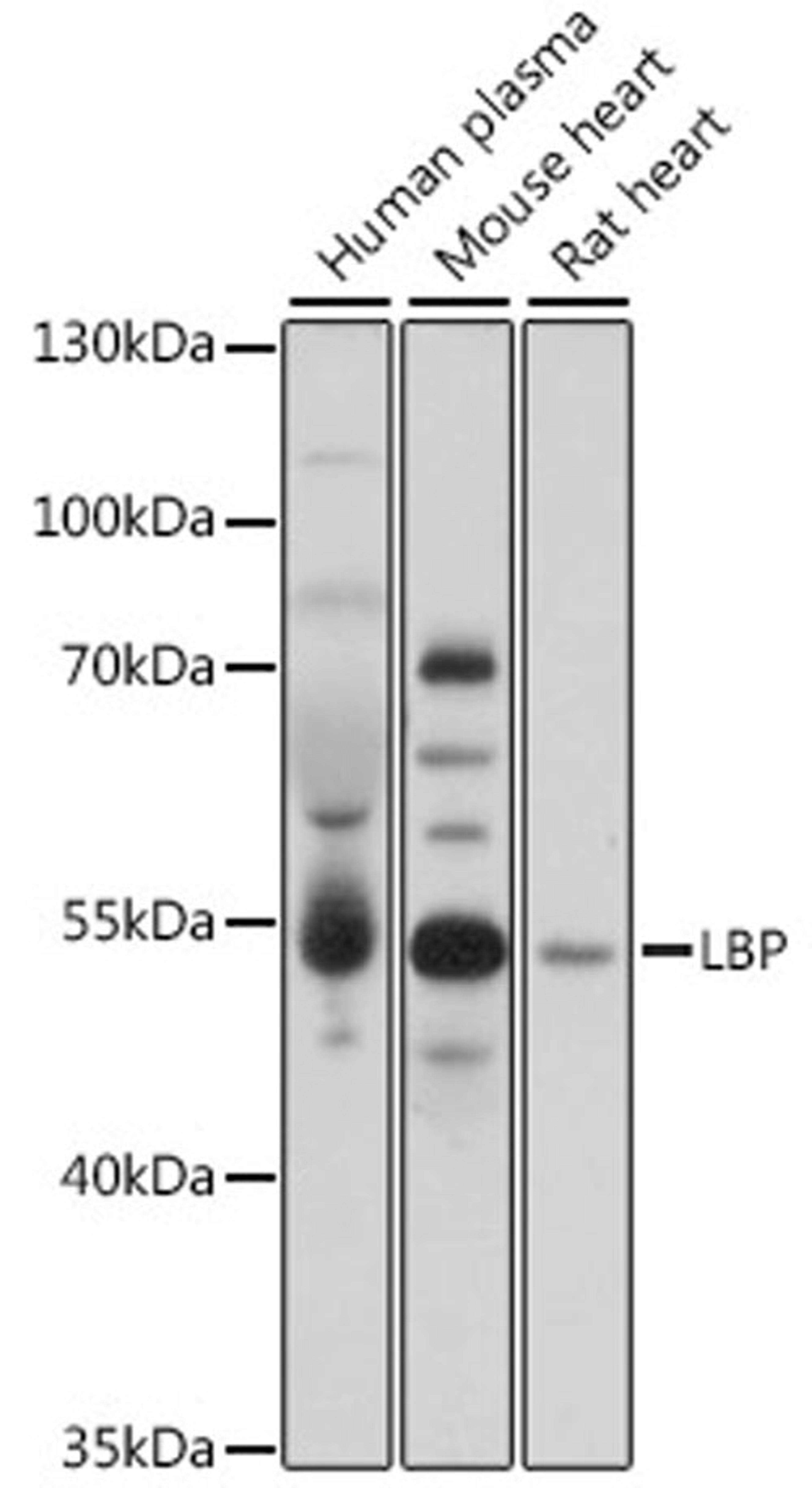 Western blot - LBP antibody (A17507)