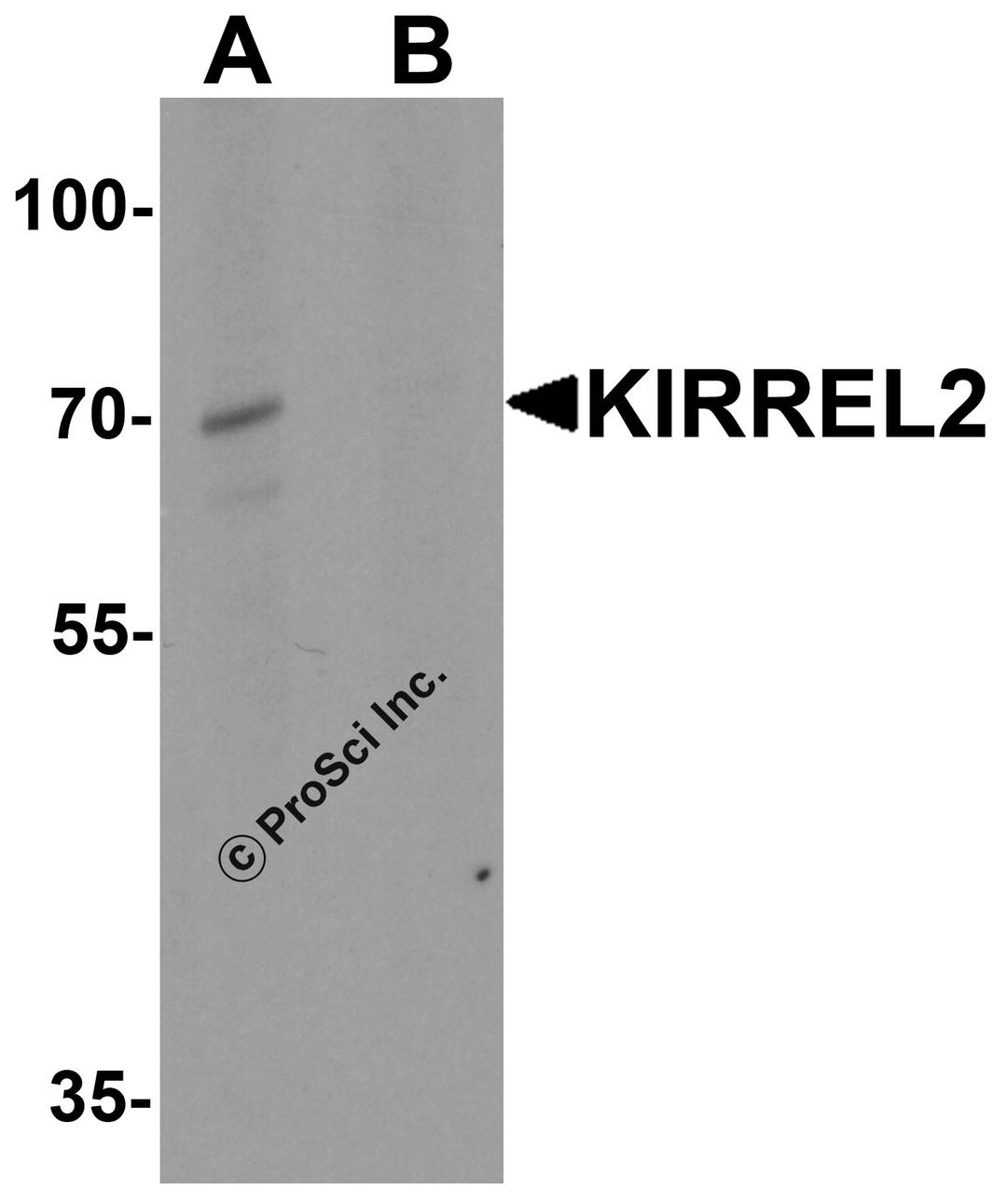 Western blot analysis of KIRREL2 in 293 cell lysate with KIRREL2 antibody at 1 μg/ml in (A) the absence and (B) the presence of blocking peptide.
