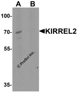 Western blot analysis of KIRREL2 in 293 cell lysate with KIRREL2 antibody at 1 μg/ml in (A) the absence and (B) the presence of blocking peptide.