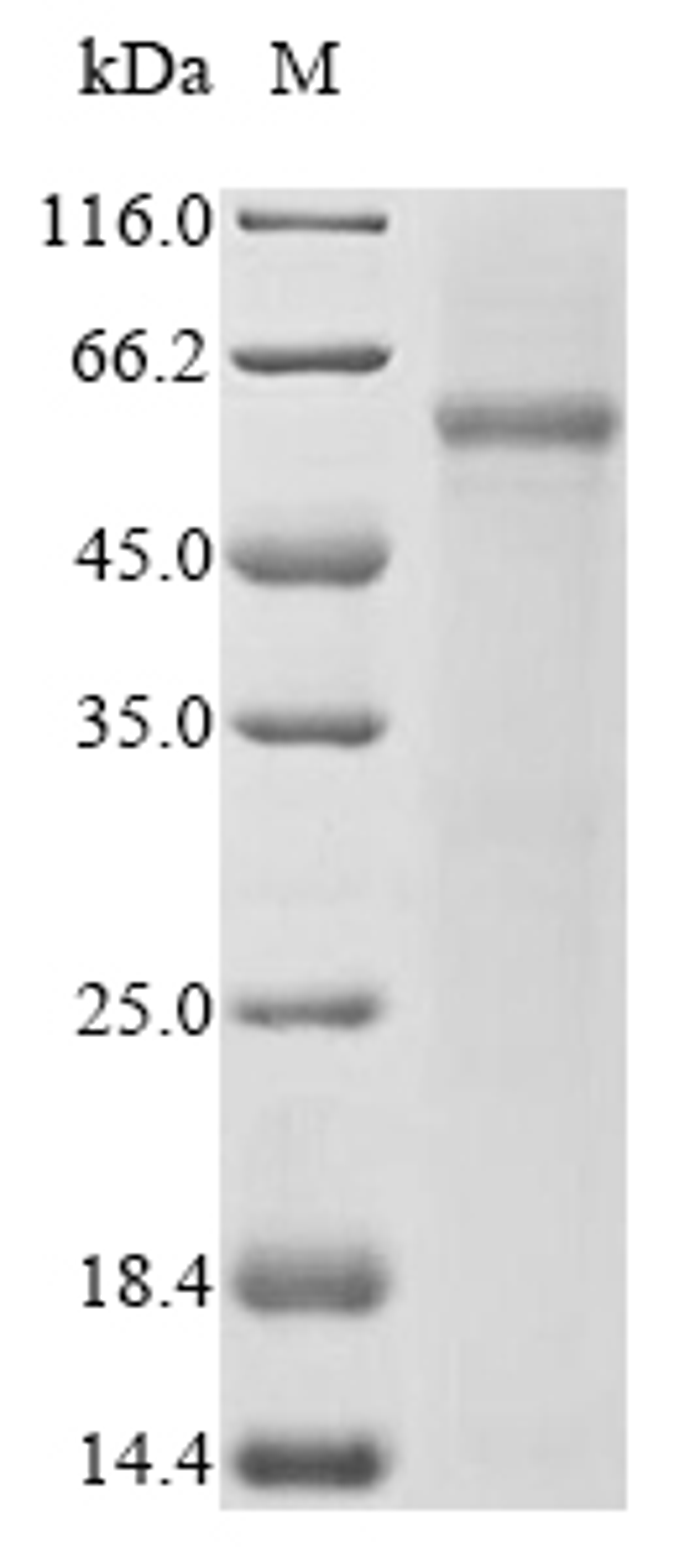 (Tris-Glycine gel) Discontinuous SDS-PAGE (reduced) with 5% enrichment gel and 15% separation gel.