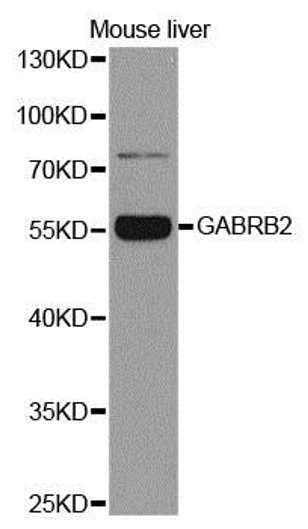 Western blot analysis of extracts of mouse liver using GABRB2 antibody