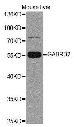 Western blot analysis of extracts of mouse liver using GABRB2 antibody