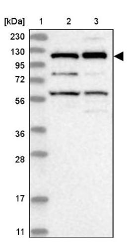 Western Blot: Kinesin 5C Antibody [NBP1-87429] - Lane 1: Marker [kDa] 230, 130, 95, 72, 56, 36, 28, 17, 11<br/>Lane 2: Human cell line RT-4<br/>Lane 3: Human cell line U-251MG sp