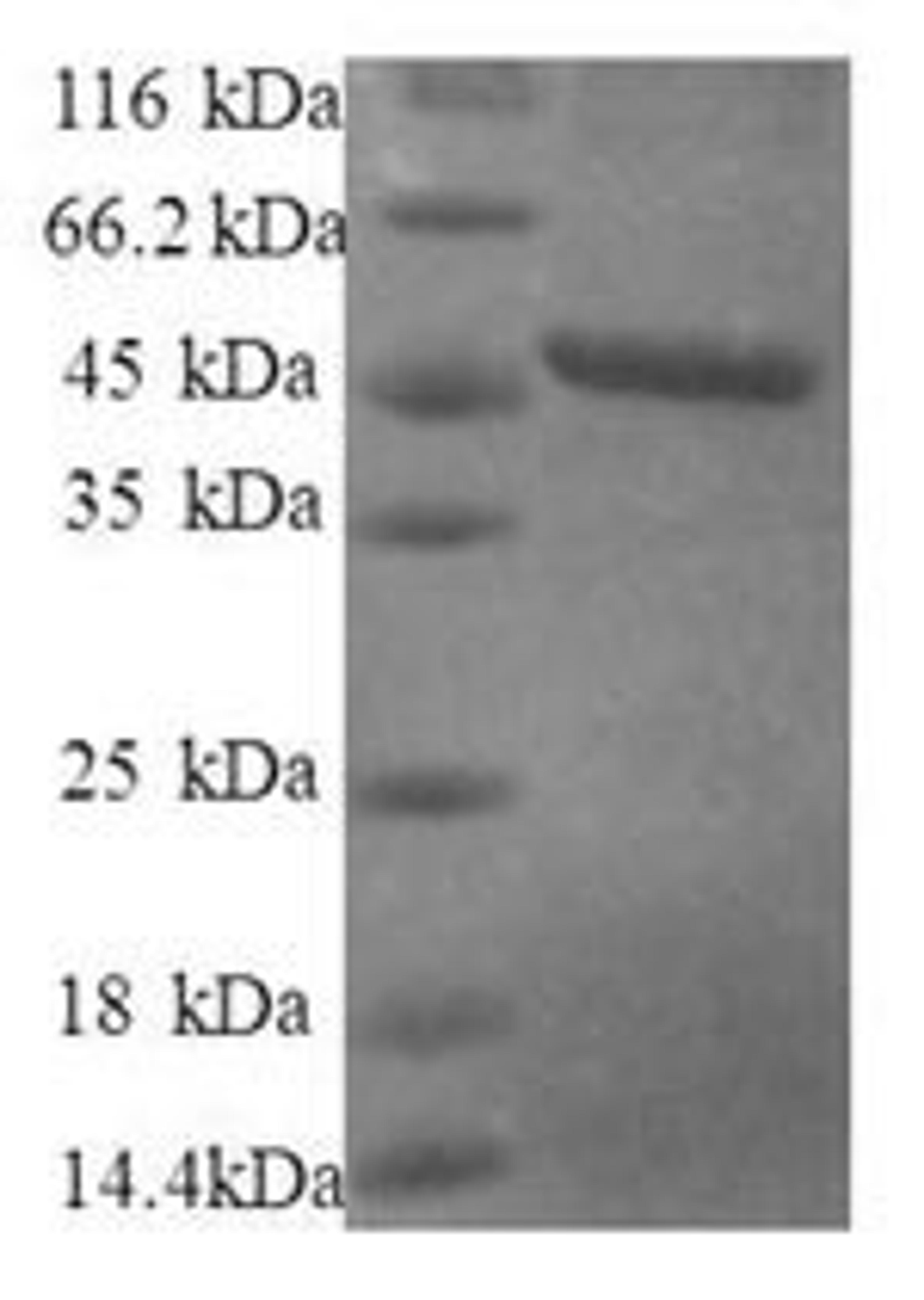 (Tris-Glycine gel) Discontinuous SDS-PAGE (reduced) with 5% enrichment gel and 15% separation gel.