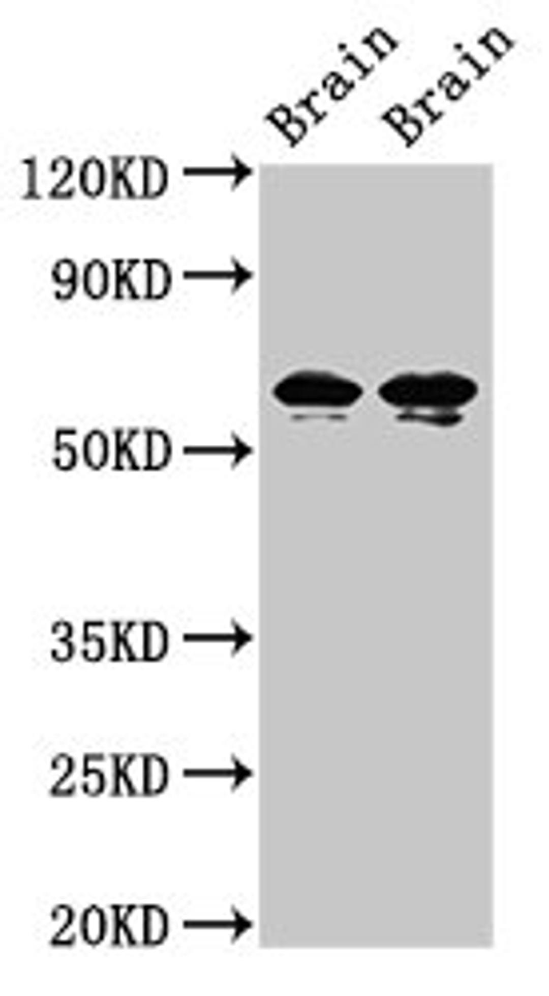 Western Blot. Positive WB detected in: Rat brain tissue, Mouse brain tissue. All lanes: STXBP1 antibody at 2ug/ml. Secondary. Goat polyclonal to rabbit IgG at 1/50000 dilution. Predicted band size: 68, 69 kDa. Observed band size: 68, 69 kDa.