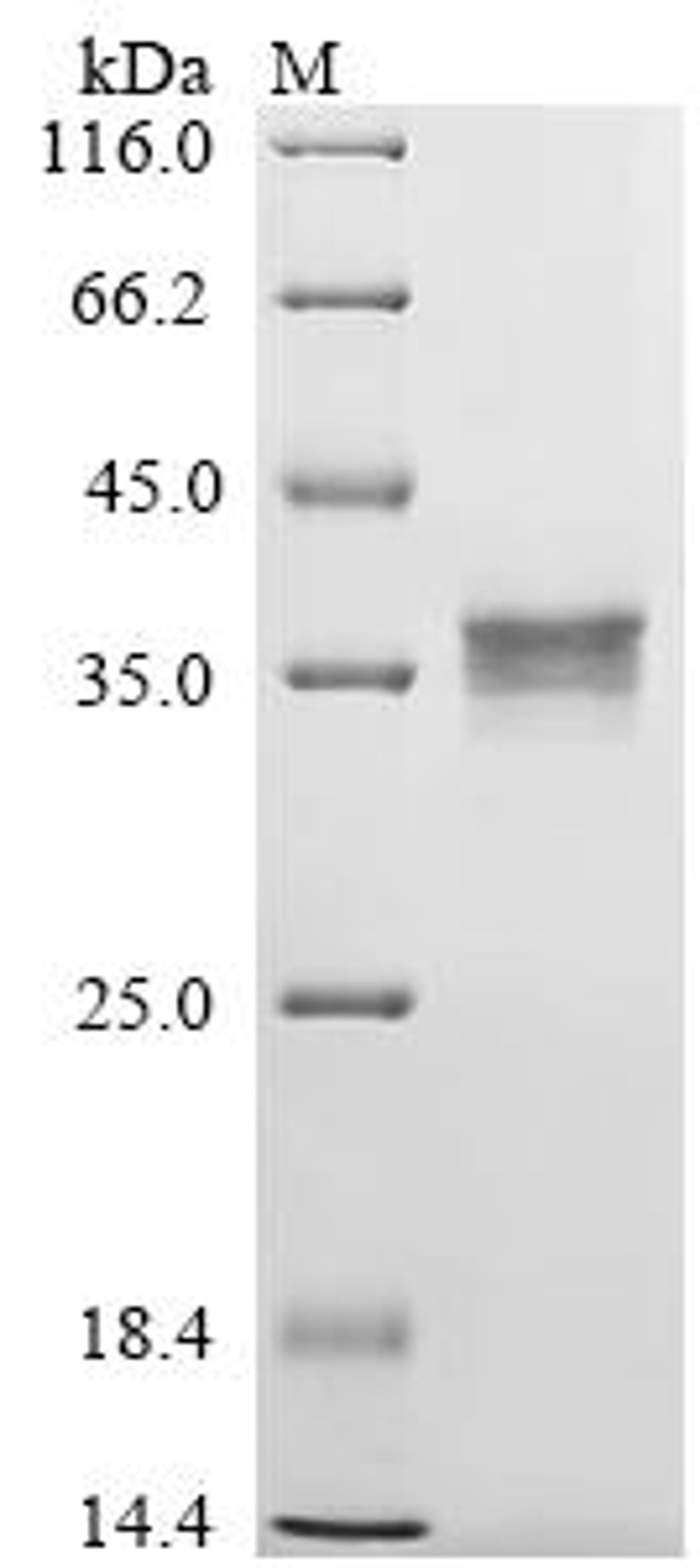 (Tris-Glycine gel) Discontinuous SDS-PAGE (reduced) with 5% enrichment gel and 15% separation gel.