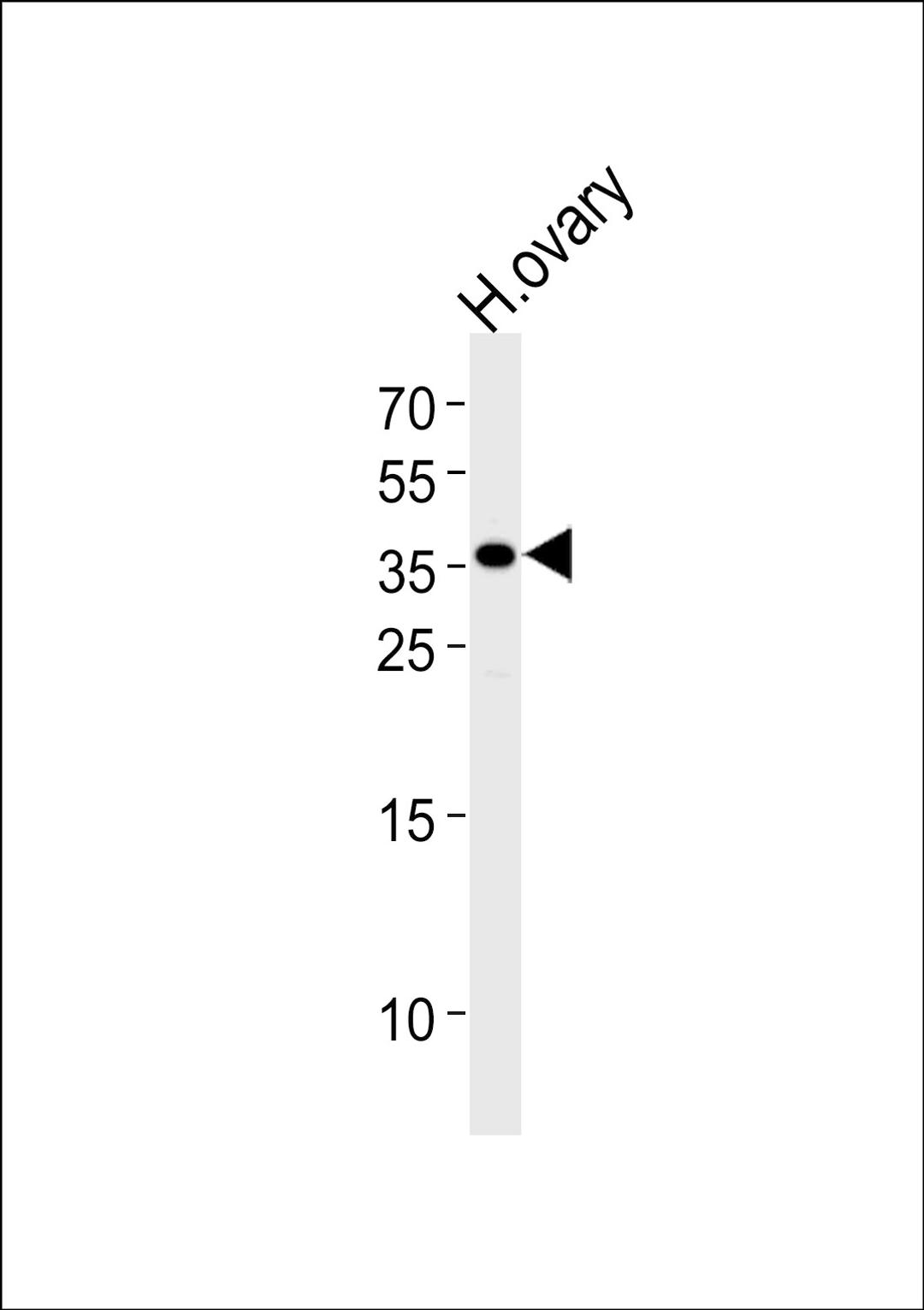 Western blot analysis of lysate from human ovary tissue lysate, using GNRHR Antibody at 1:1000 at each lane.