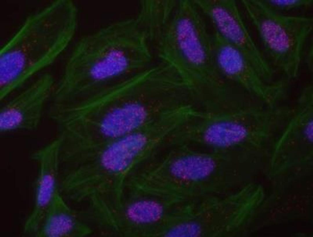 Proximity Ligation Assay: NIF1 Antibody [NB100-2579] - Secondary-conjugate Duolink In Situ PLA in Hela cells. goat anti-human DBC1 (NBP2-22294) and rabbit anti-human NIF1 (NB100-2579). Image merged from DAPI (2ms), FITC/Green (25ms) and Red (200ms) exposures, 40X magnification. Control images may not have counterstained cytoplasm.