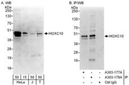 Detection of human HOXC10 by western blot and immunoprecipitation.