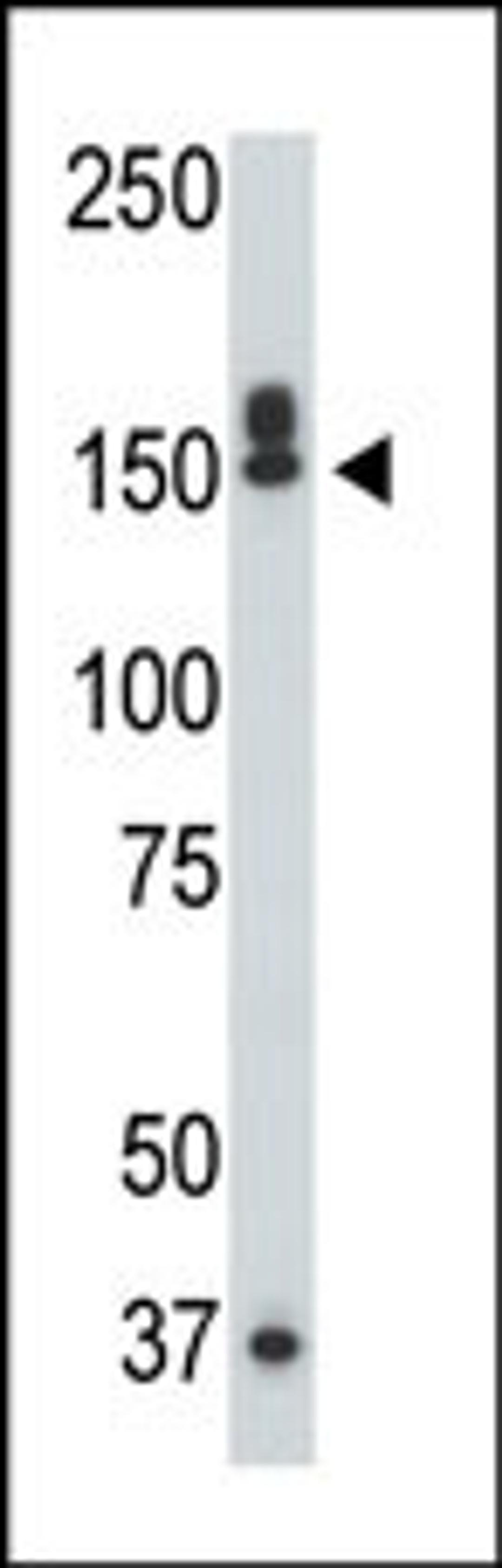 Antibody is used in Western blot to detect DAPK1 in mouse liver tissue lysate.