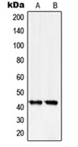 Western blot analysis of A431 (Lane 1), HeLa (Lane 2) whole cell lysates using SERPINB5 antibody