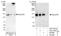 Detection of human Caf1p150 by western blot and immunoprecipitation.