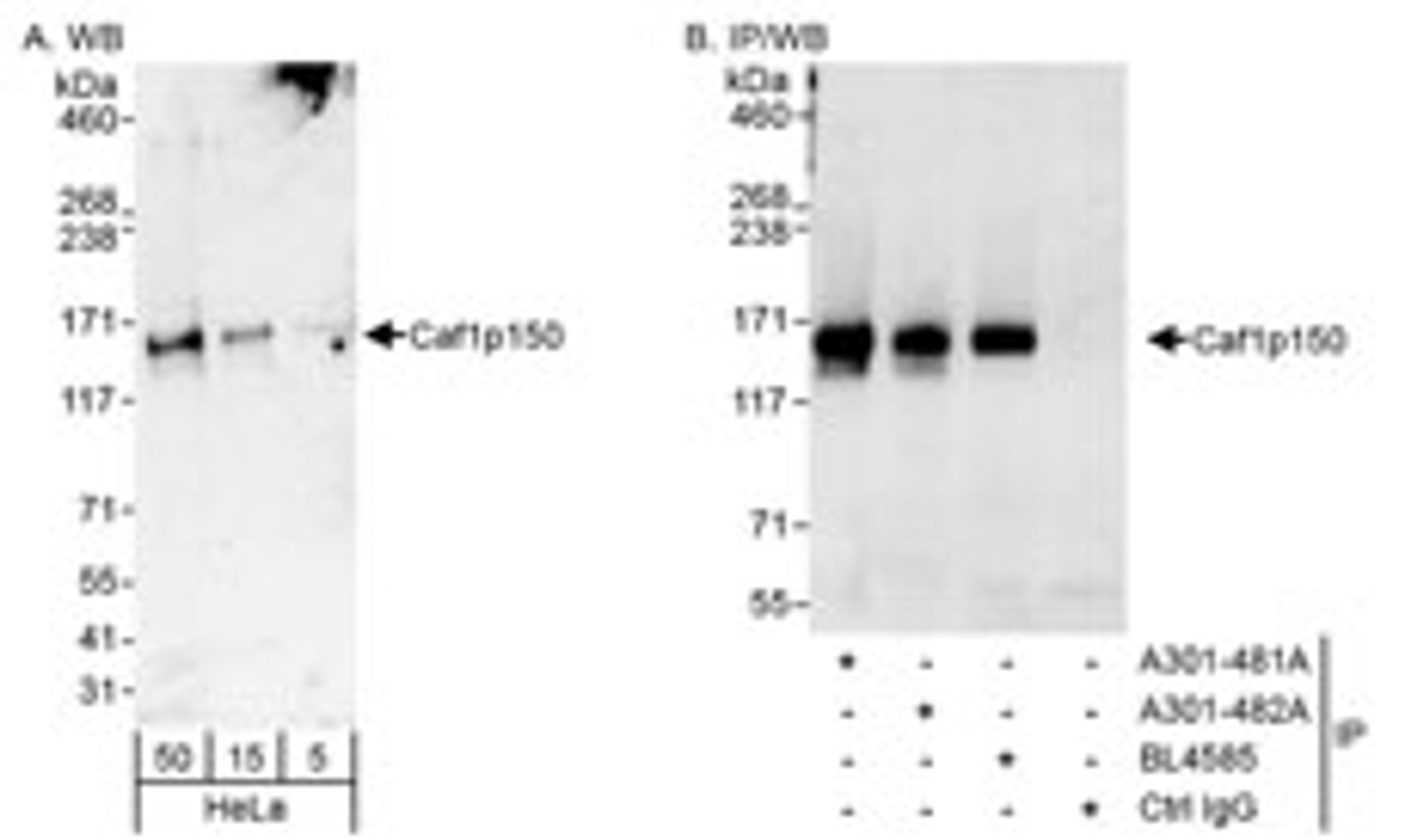 Detection of human Caf1p150 by western blot and immunoprecipitation.