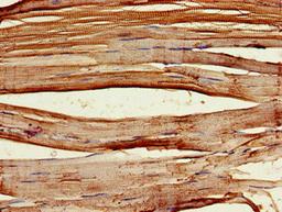 Immunohistochemistry of paraffin-embedded human skeletal muscle tissue using CSB-PA705514LA01HU at dilution of 1:100