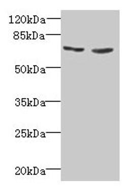 Western blot. All lanes: TNFRSF11A antibody at 2µg/ml. Lane 1: EC109 whole cell lysate. Lane 2: 293T whole cell lysate. Secondary. Goat polyclonal to rabbit IgG at 1/15000 dilution. Predicted band size: 67, 33, 37, 29, 57, 65 kDa. Observed band size: 67 kDa