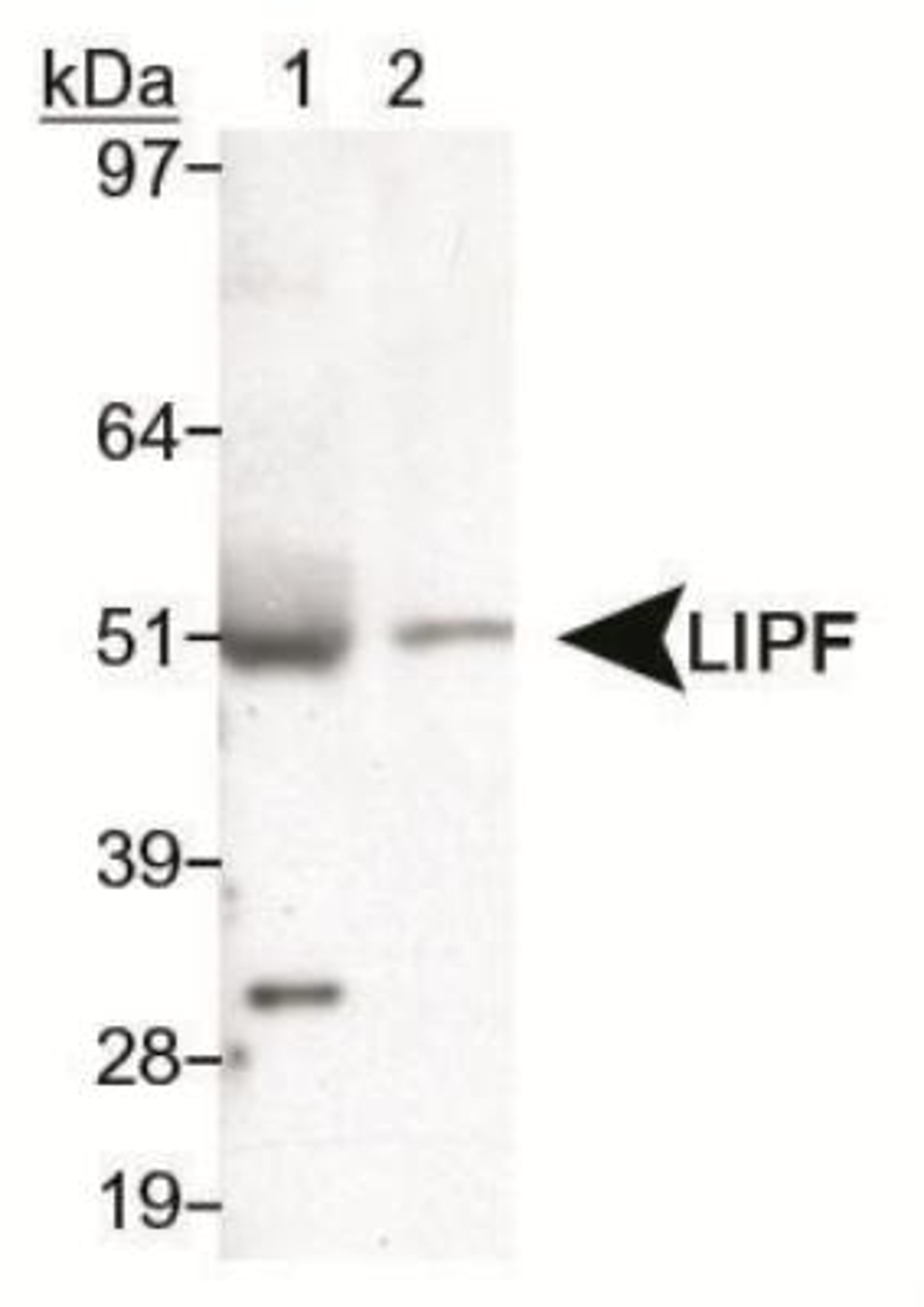 Western Blot: Gastric Lipase Antibody [NB110-60930] - Detection of LIPF in liver lysate using NB110-60930. Lane 1: human Lane 2: mouse