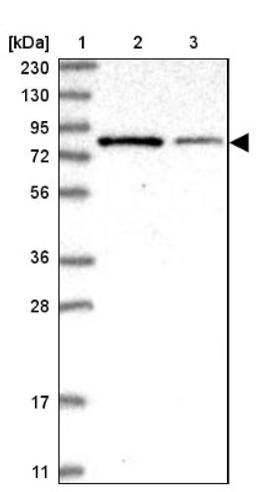 Western Blot: PGBD2 Antibody [NBP1-85936] - Lane 1: Marker [kDa] 230, 130, 95, 72, 56, 36, 28, 17, 11<br/>Lane 2: Human cell line RT-4<br/>Lane 3: Human cell line U-251MG sp