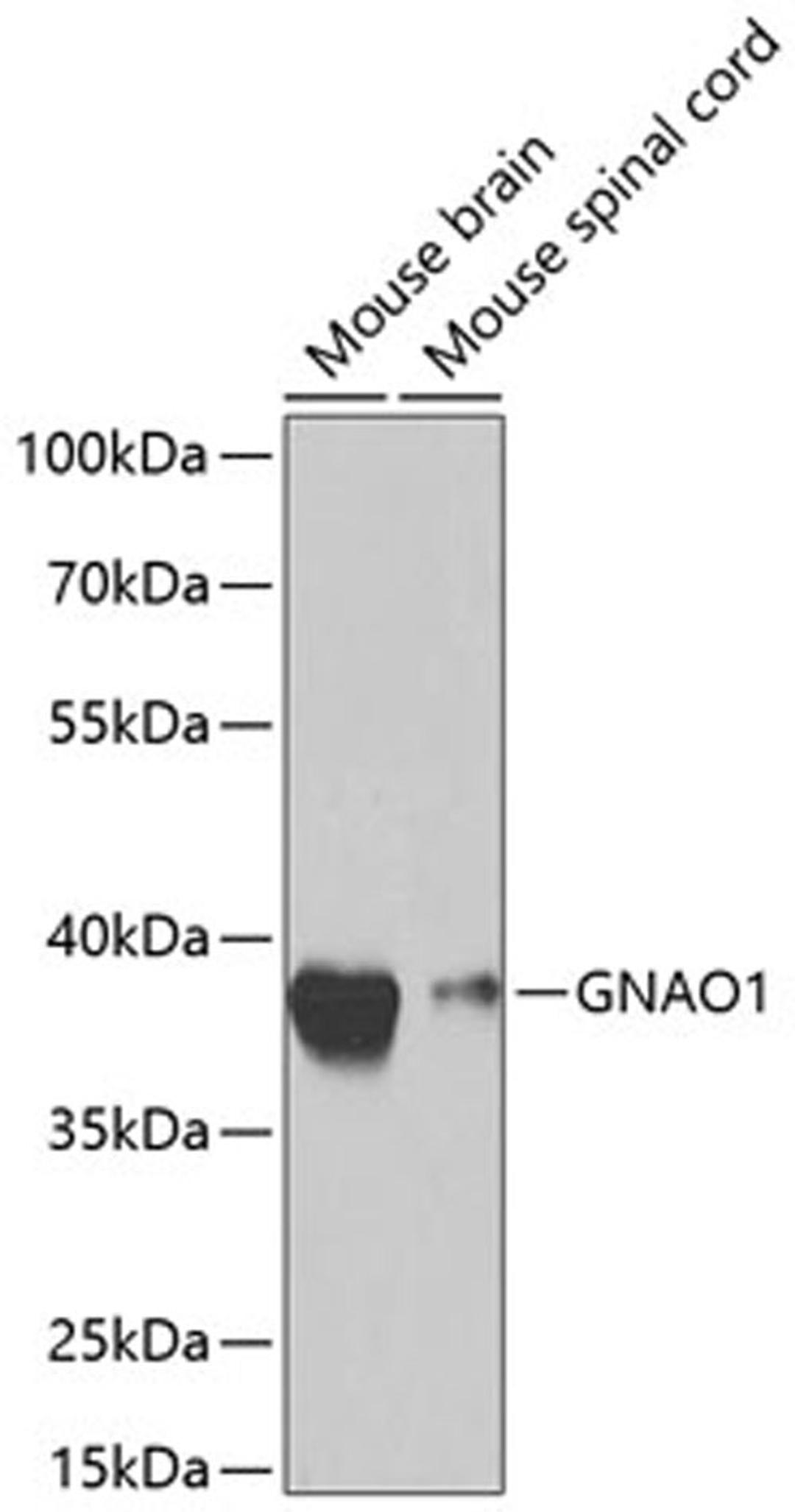 Western blot - GNAO1 antibody (A2510)