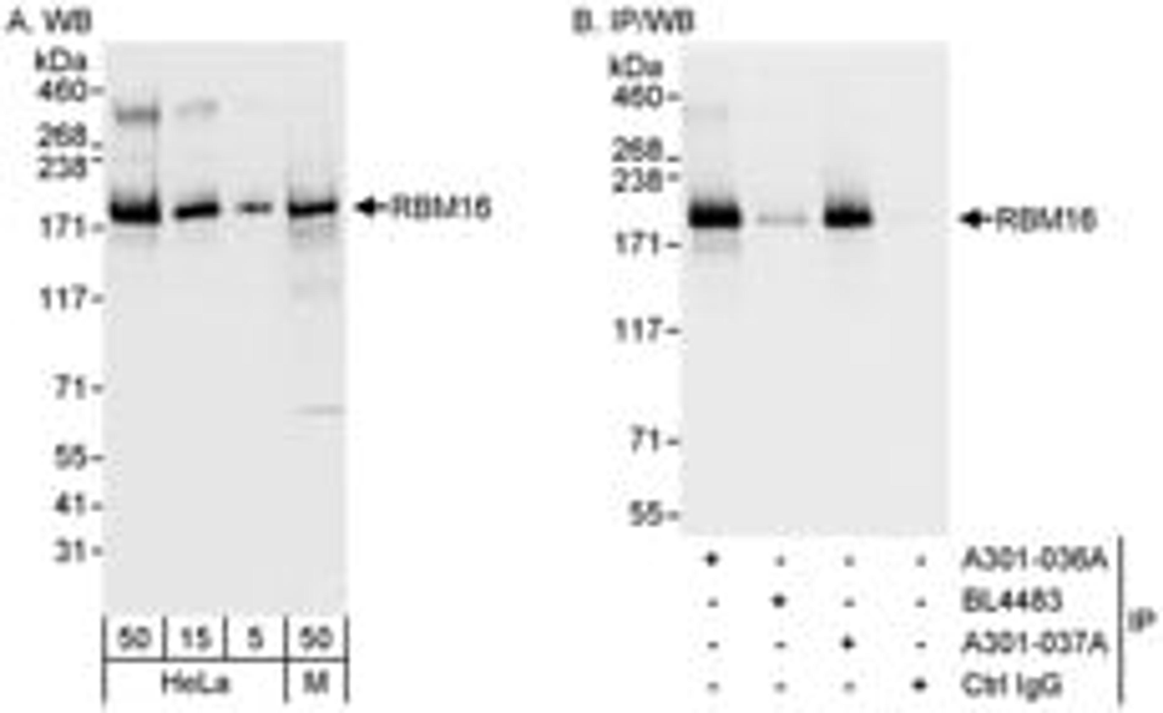 Detection of human and mouse RBM16 by western blot (h&m) and immunoprecipitation (h).