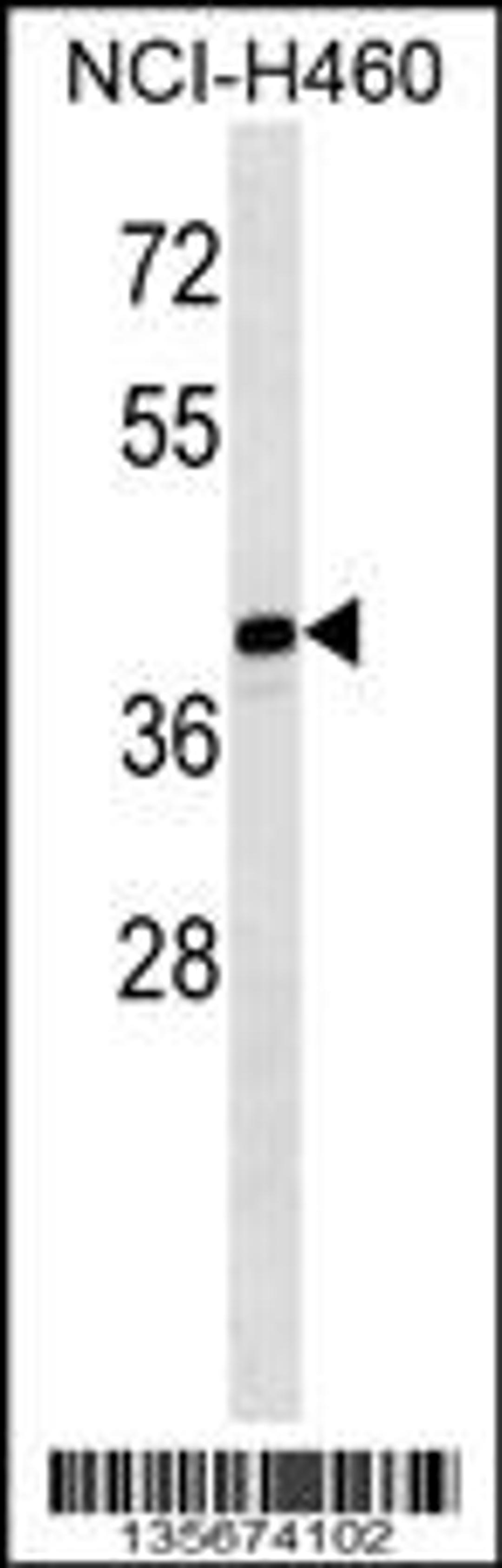 Western blot analysis in NCI-H460 cell line lysates (35ug/lane).