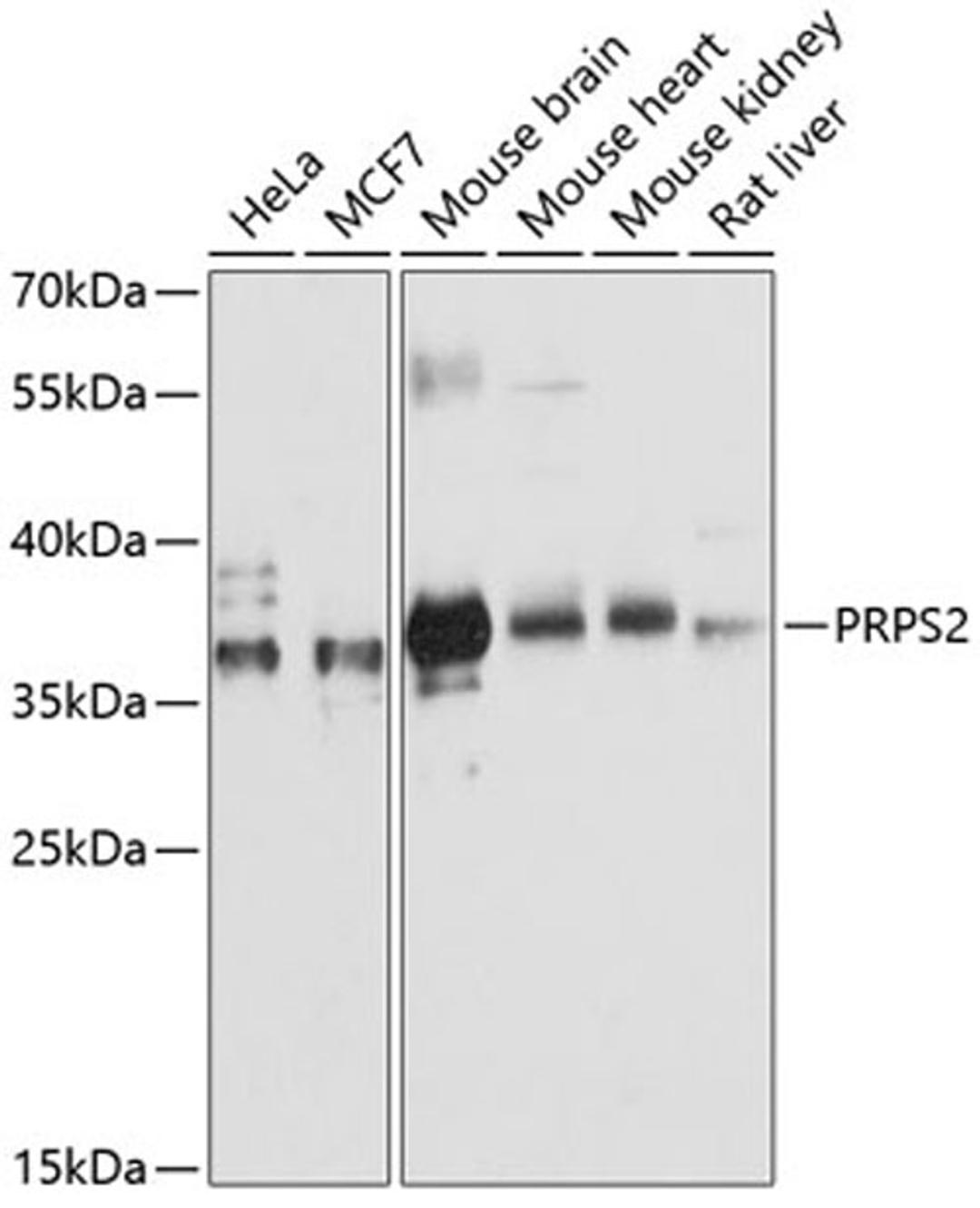 Western blot - PRPS2 antibody (A12644)