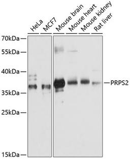 Western blot - PRPS2 antibody (A12644)