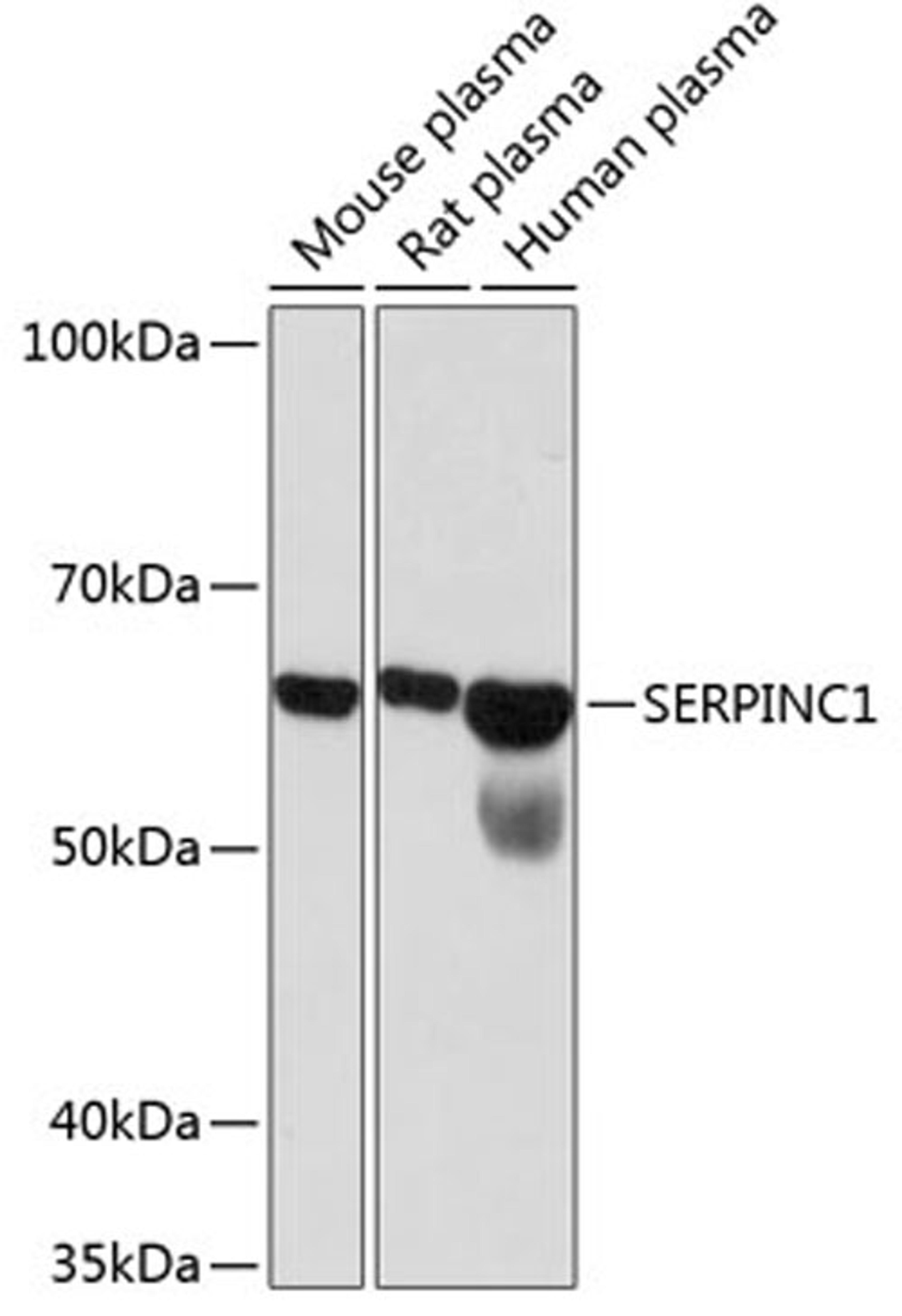 Western blot - SERPINC1 Rabbit mAb (A11249)