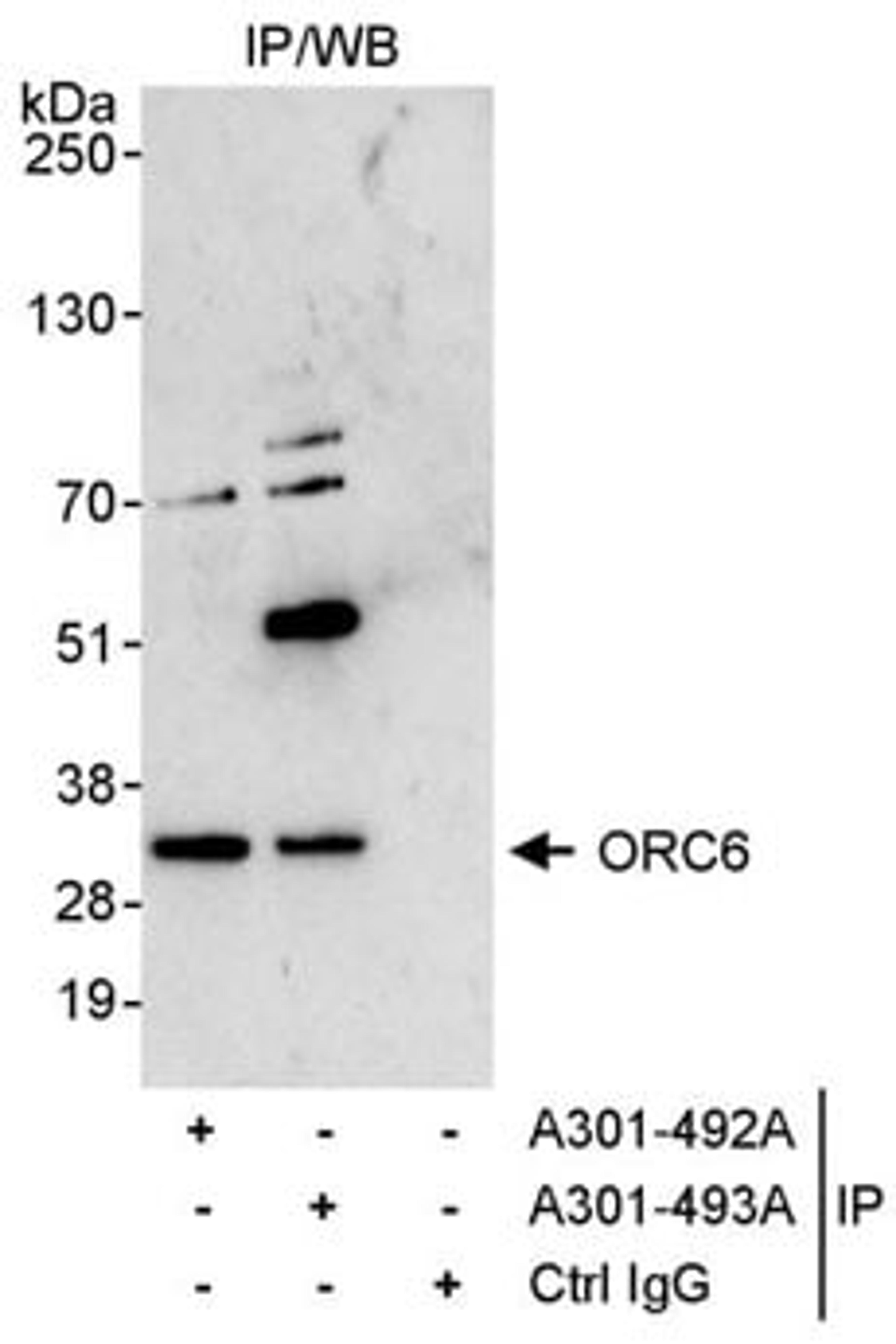 Detection of human ORC6 by western blot of immunoprecipitates.