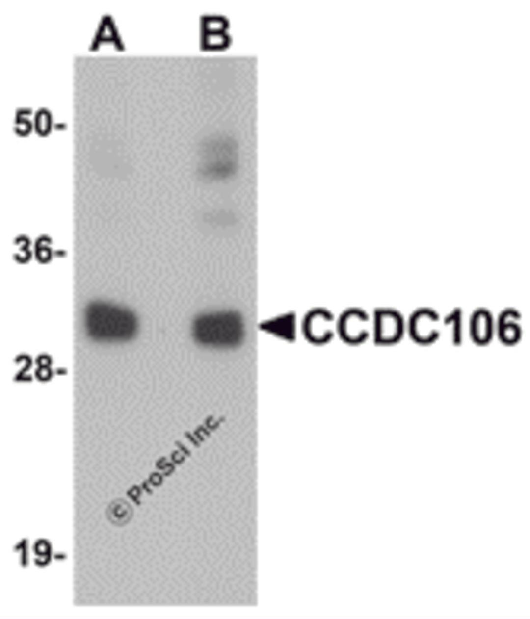 Western blot analysis of CCDC106 in human brain tissue lysate with CCDC106 antibody at (A) 0.5 and (B) 1 &#956;g/mL.