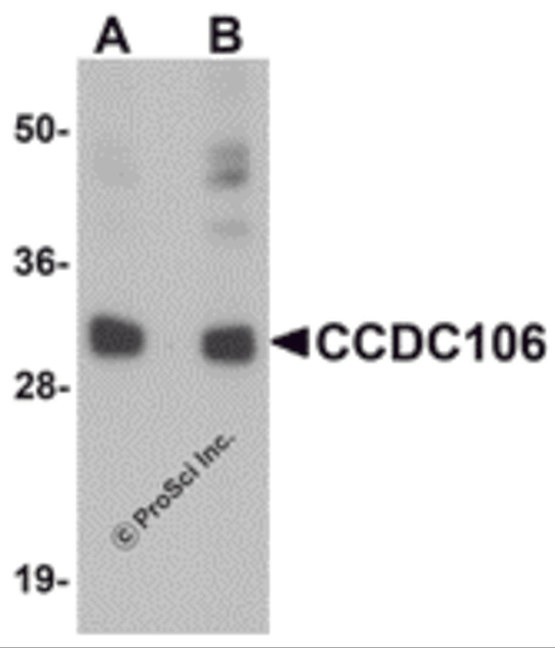 Western blot analysis of CCDC106 in human brain tissue lysate with CCDC106 antibody at (A) 0.5 and (B) 1 μg/mL.