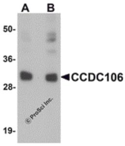 Western blot analysis of CCDC106 in human brain tissue lysate with CCDC106 antibody at (A) 0.5 and (B) 1 μg/mL.
