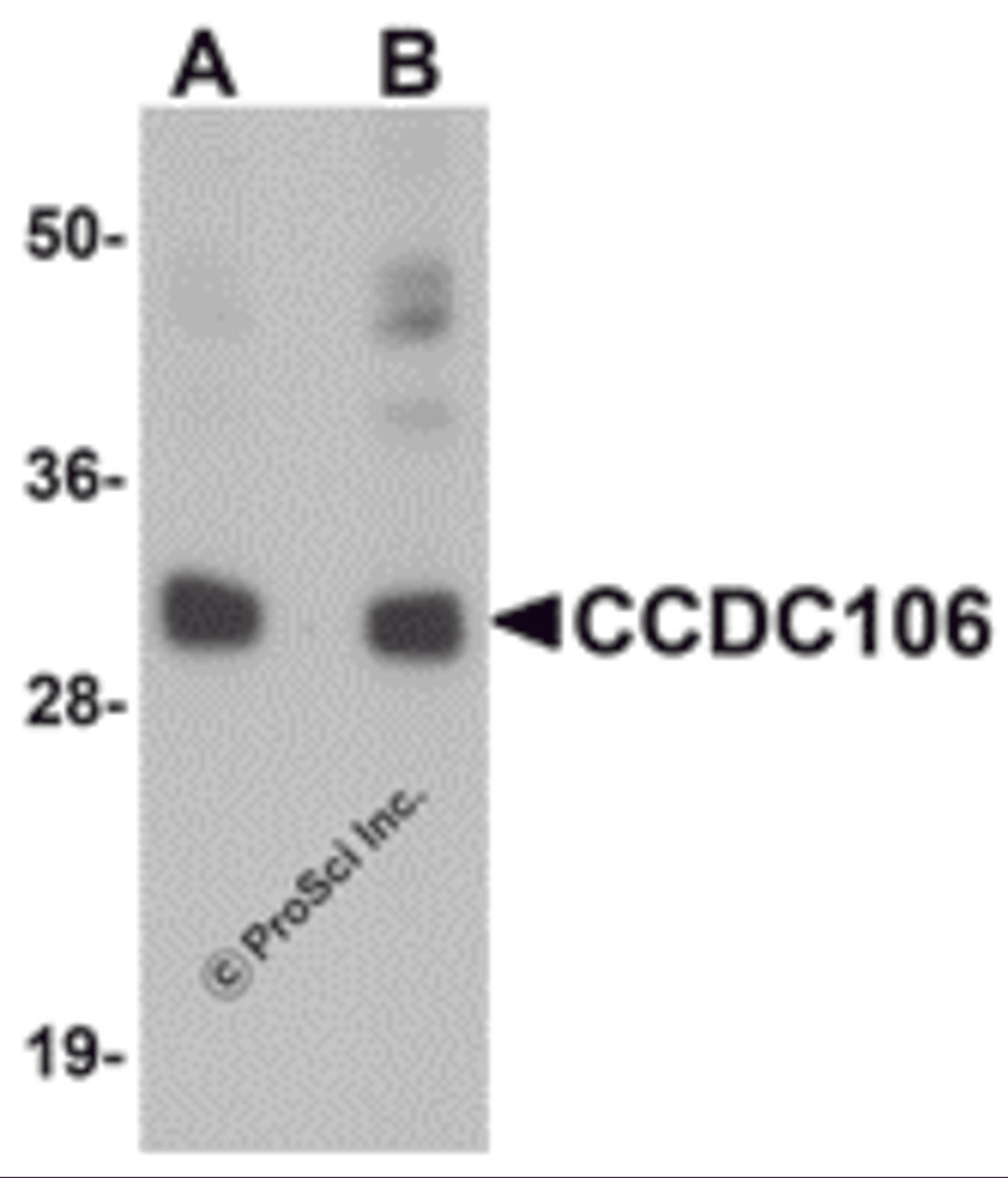 Western blot analysis of CCDC106 in human brain tissue lysate with CCDC106 antibody at (A) 0.5 and (B) 1 μg/mL.