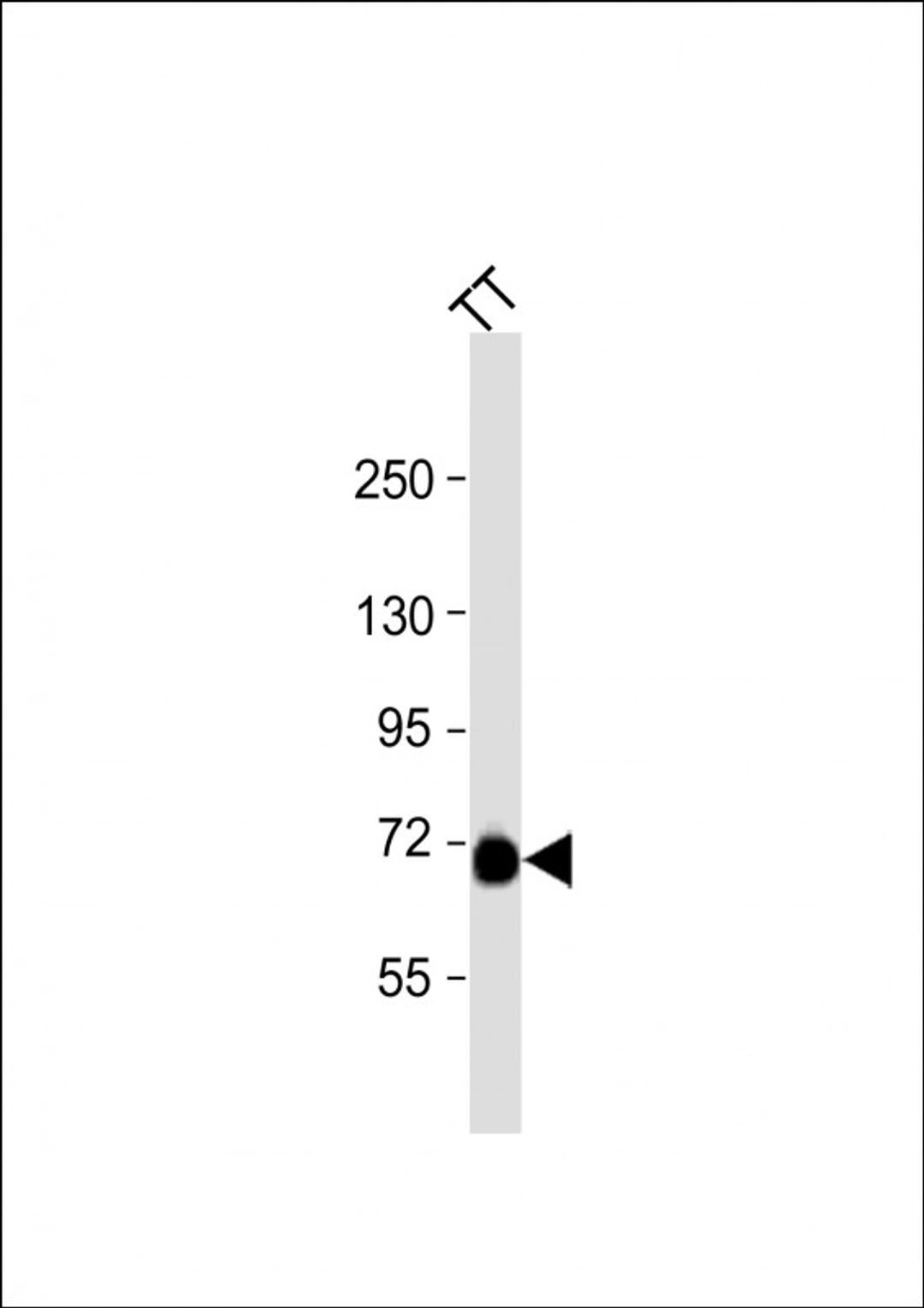 Western Blot at 1:1000 dilution + TT whole cell lysate Lysates/proteins at 20 ug per lane.