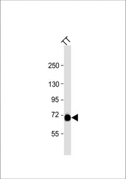 Western Blot at 1:1000 dilution + TT whole cell lysate Lysates/proteins at 20 ug per lane.