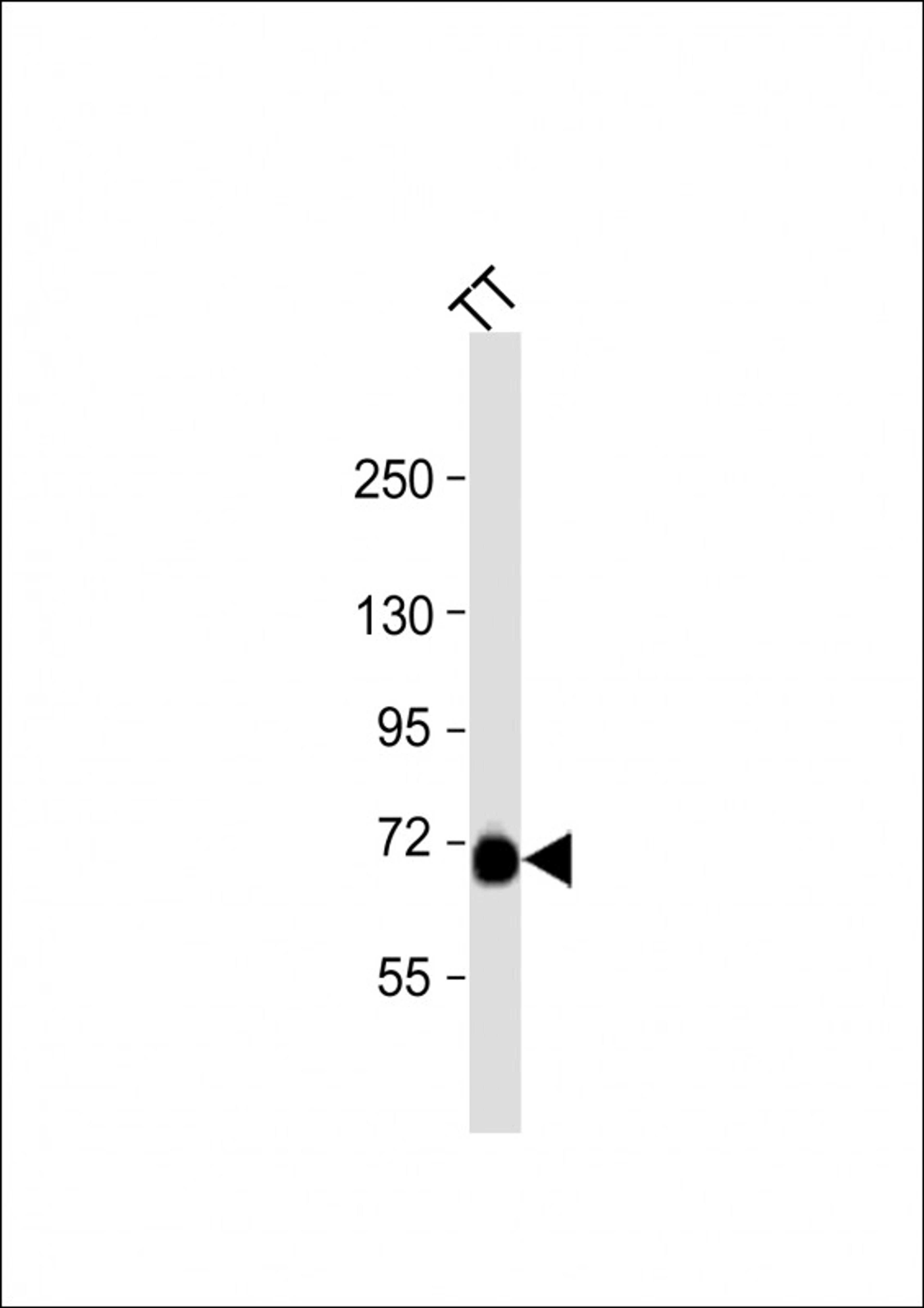 Western Blot at 1:1000 dilution + TT whole cell lysate Lysates/proteins at 20 ug per lane.