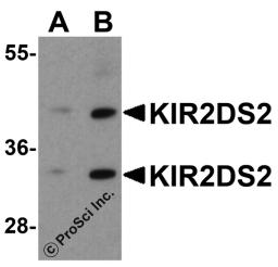 Western blot analysis of KIR2DS2 in 293 cell lysate with KIR2DS2 antibody at (A) 1 and (B) 2 &#956;g/ml.