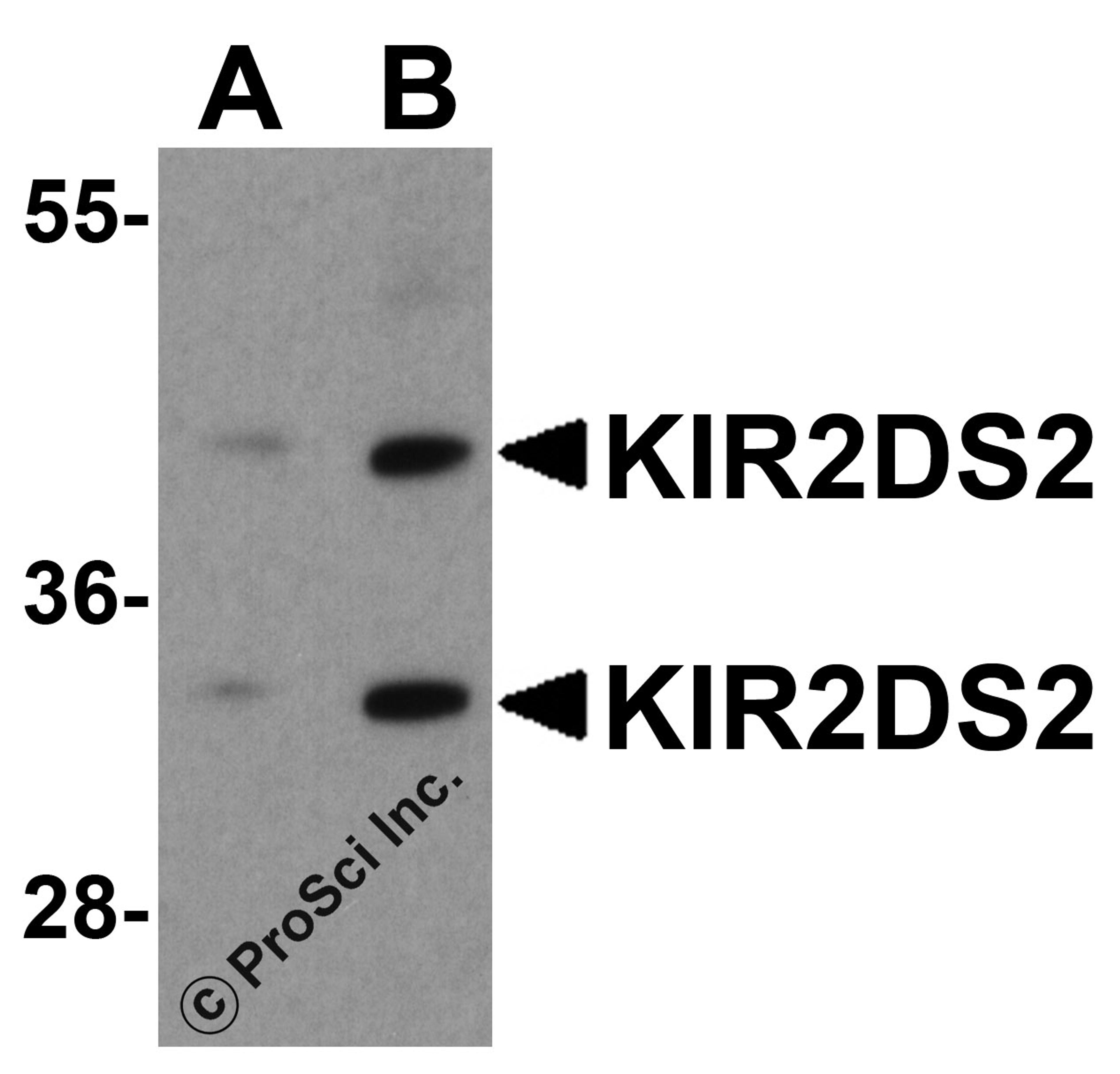 Western blot analysis of KIR2DS2 in 293 cell lysate with KIR2DS2 antibody at (A) 1 and (B) 2 &#956;g/ml.