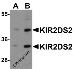 Western blot analysis of KIR2DS2 in 293 cell lysate with KIR2DS2 antibody at (A) 1 and (B) 2 μg/ml.