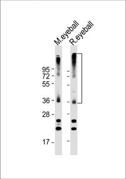 Western Blot at 1:2000 dilution Lane 1: mouse eyeball lysate Lane 2: rat eyeball lysate Lysates/proteins at 20 ug per lane.