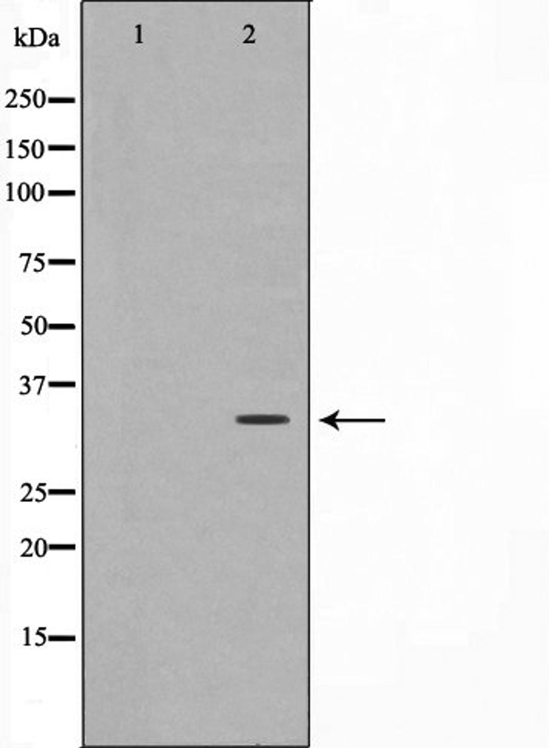 Western blot analysis of HuvEc cell lysate using C/EBP-epsilon antibody