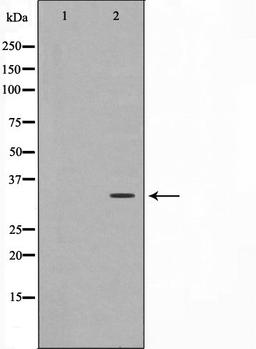 Western blot analysis of HuvEc cell lysate using C/EBP-epsilon antibody