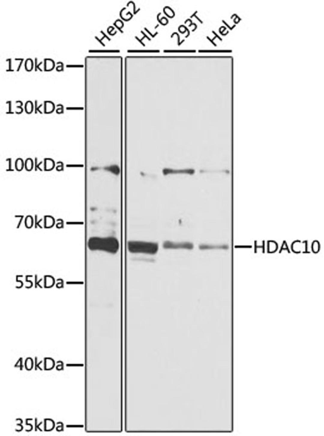 Western blot - HDAC10 antibody (A6184)