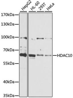 Western blot - HDAC10 antibody (A6184)