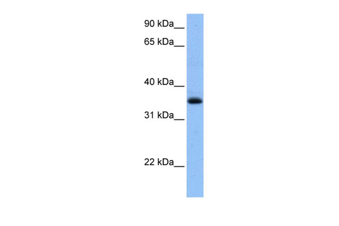 Antibody used in WB on Human Liver at 0.2-1 ug/ml.