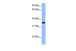 Antibody used in WB on Human Liver at 0.2-1 ug/ml.